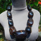 335 gr 9 beads Big Necklace Indonesian dark Amber for Healing A9K26